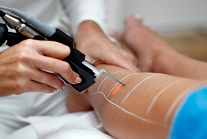 epilation_definitive
